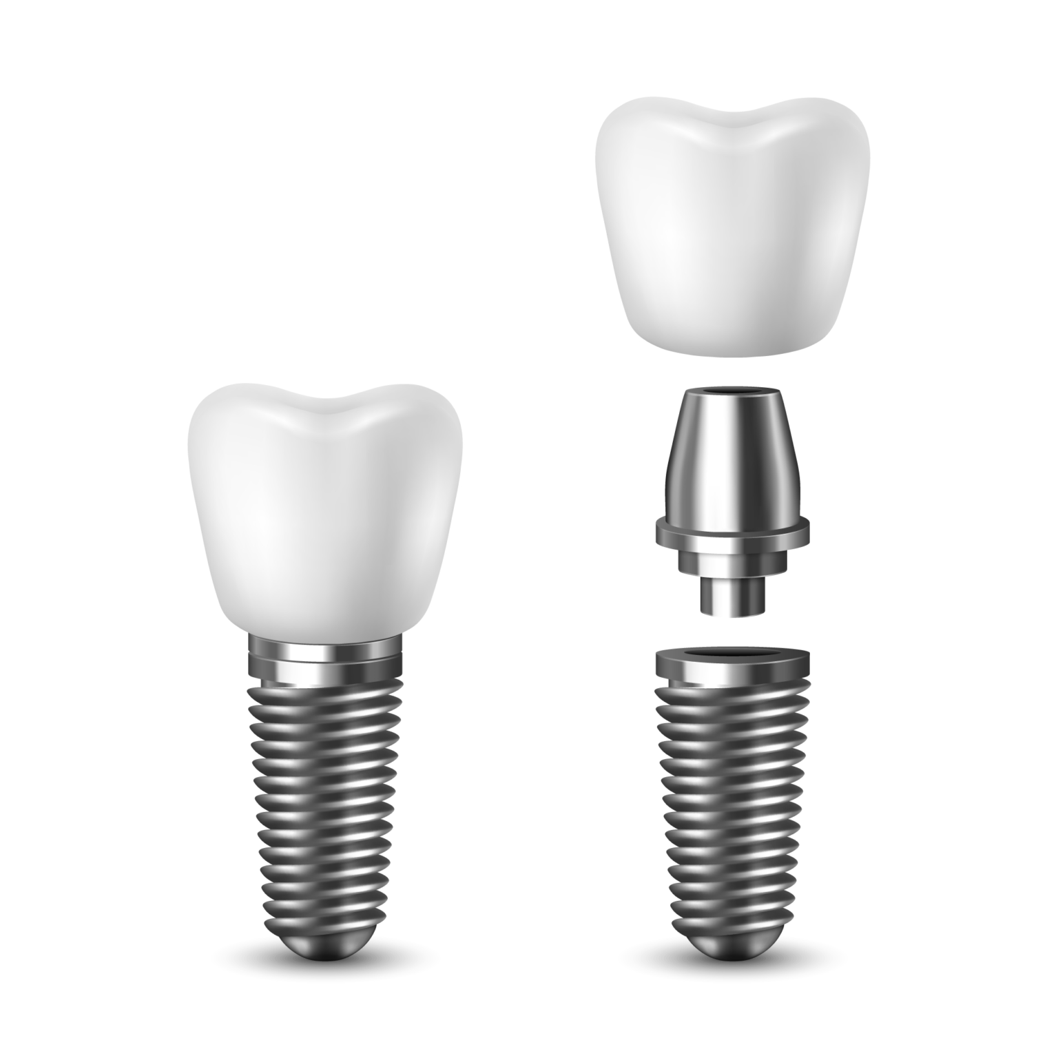 does-medicare-cover-dental-implants-medicarefaq